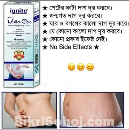 ignite mother care lotion